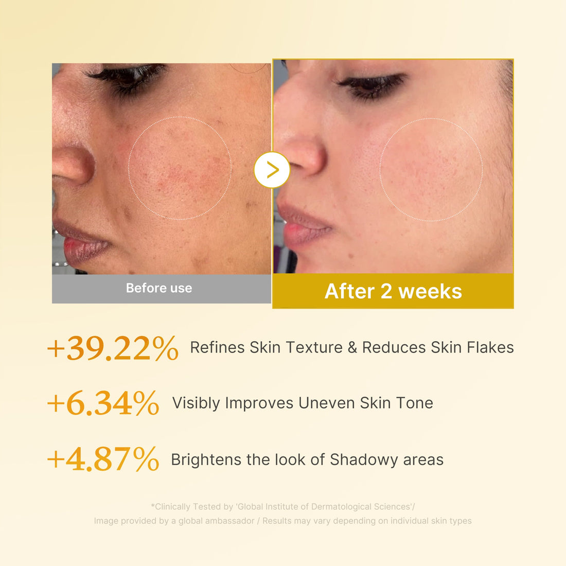 Medicube Kojic Acid Turmeric Resurfacing Toner – før og efter samt producentens testresultater