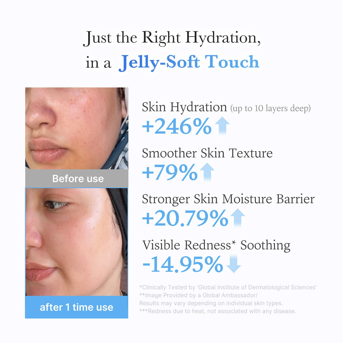 Medicube Hyaluronic Ceramide Jelly Cream – før og efter samt producentens testresultater