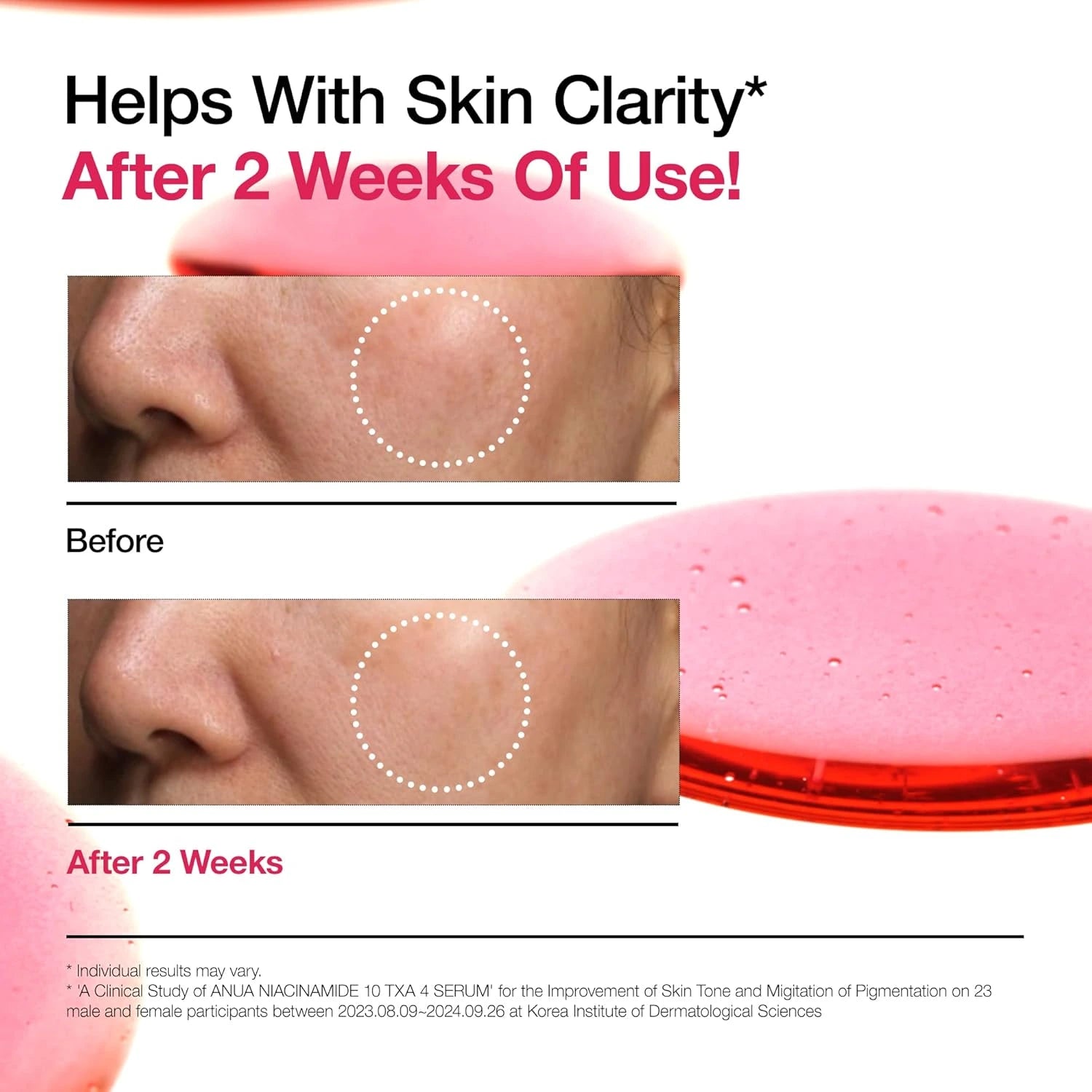 anua niacinamide 10 + txa 4 serum info billede