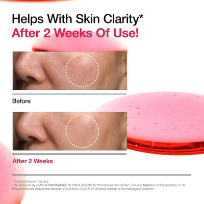 anua niacinamide 10 + txa 4 serum info billede
